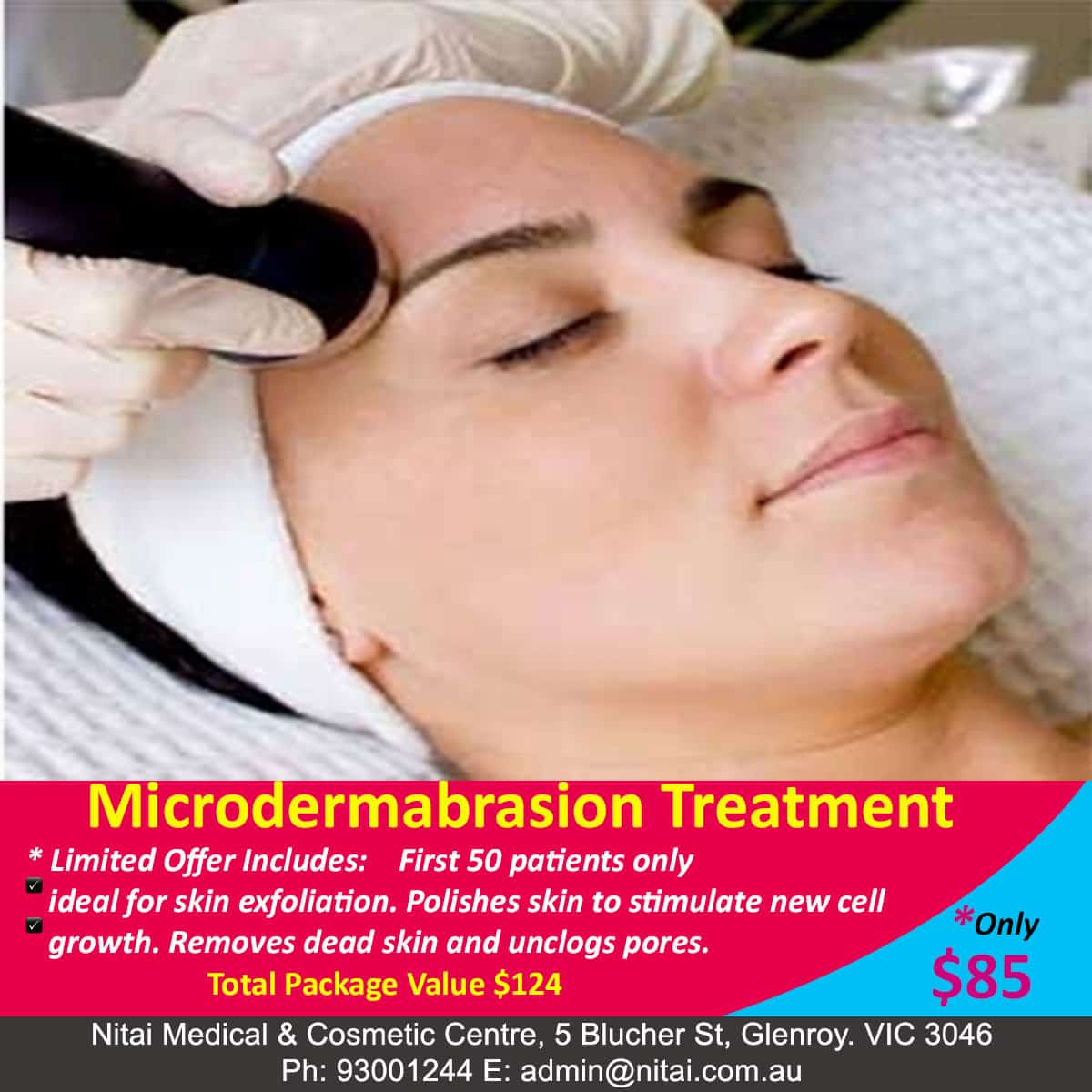 Microdermabrasion Treatment Special - 1
