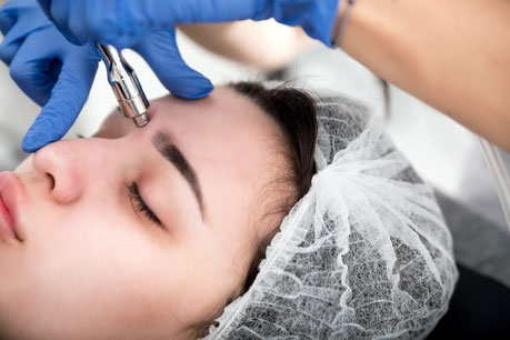 Microdermabrasion Melbourne: The Best Treatment for your Skin - 7