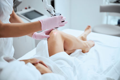 Top Treatments for Spider Vein Removal Melbourne - 9