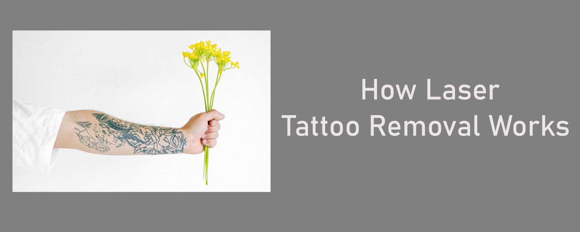 How Laser Tattoo Removal Works - 1