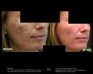 Facial Treatment BA Images