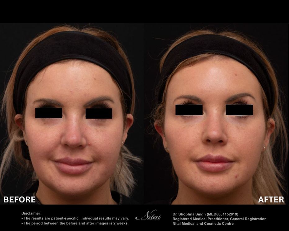 Dermal Treatment BA Image