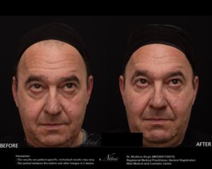 Dermal Treatment BA Image