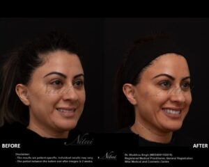 Dermal Treatment BA Image