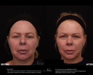 Dermal Treatment BA Image