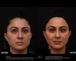 Dermal Treatment BA Image