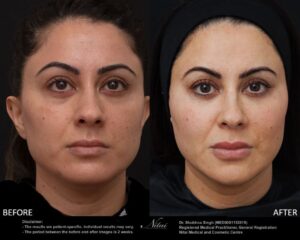 Dermal Treatment BA Image