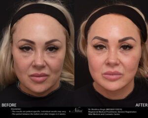 Dermal Treatment BA Image