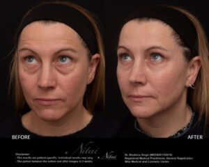 Dermal Treatment BA Image