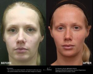 Dermal Treatment BA Image