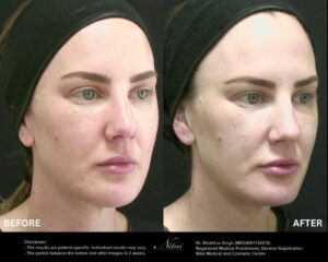 Dermal Treatment BA Image