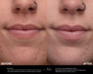 Dermal Treatment BA Image