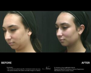 Dermal Treatment BA Image