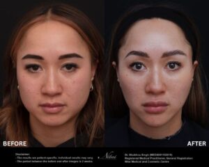 Dermal Treatment BA Image