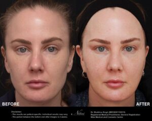 Dermal Treatment BA Image