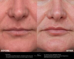 Dermal Treatment BA Image