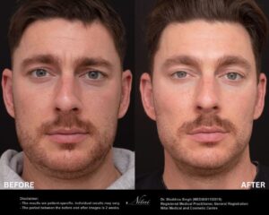 Dermal Treatment BA Image