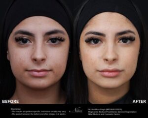 Dermal Treatment BA Image