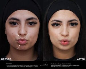 Dermal Treatment BA Image