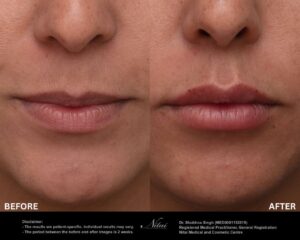 Dermal Treatment BA Image