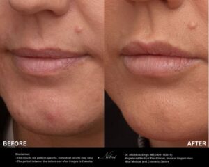 Dermal Treatment BA Image