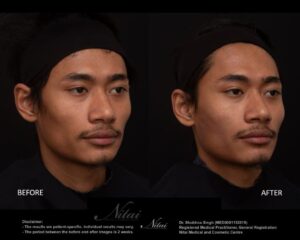 Dermal Treatment BA Image