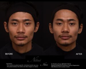 Dermal Treatment BA Image