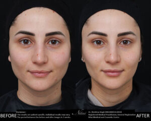 Facial Treatment BA Images
