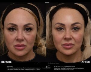 Dermal Treatment BA Image