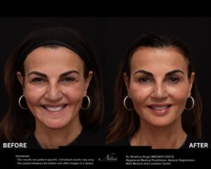 Dermal Treatment BA Image