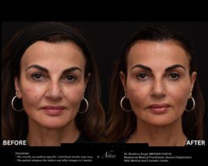 Dermal Treatment BA Image