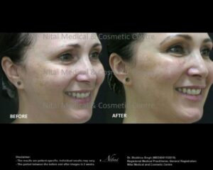 Dermal Treatment BA Image