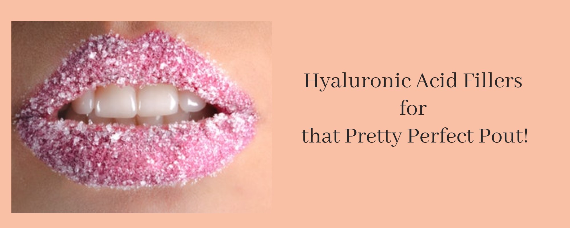 Hyaluronic Acid Fillers for Lips