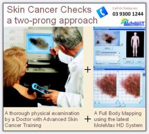Skin cancer check 01