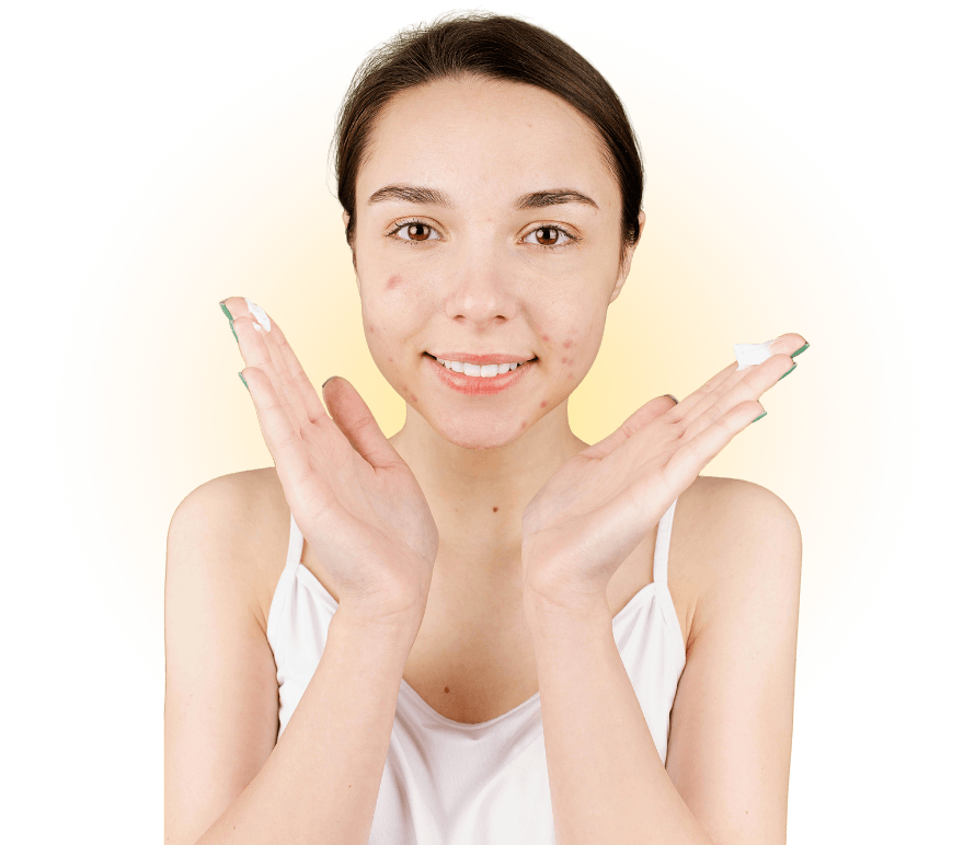 Acne & Acne Scarring Treatments