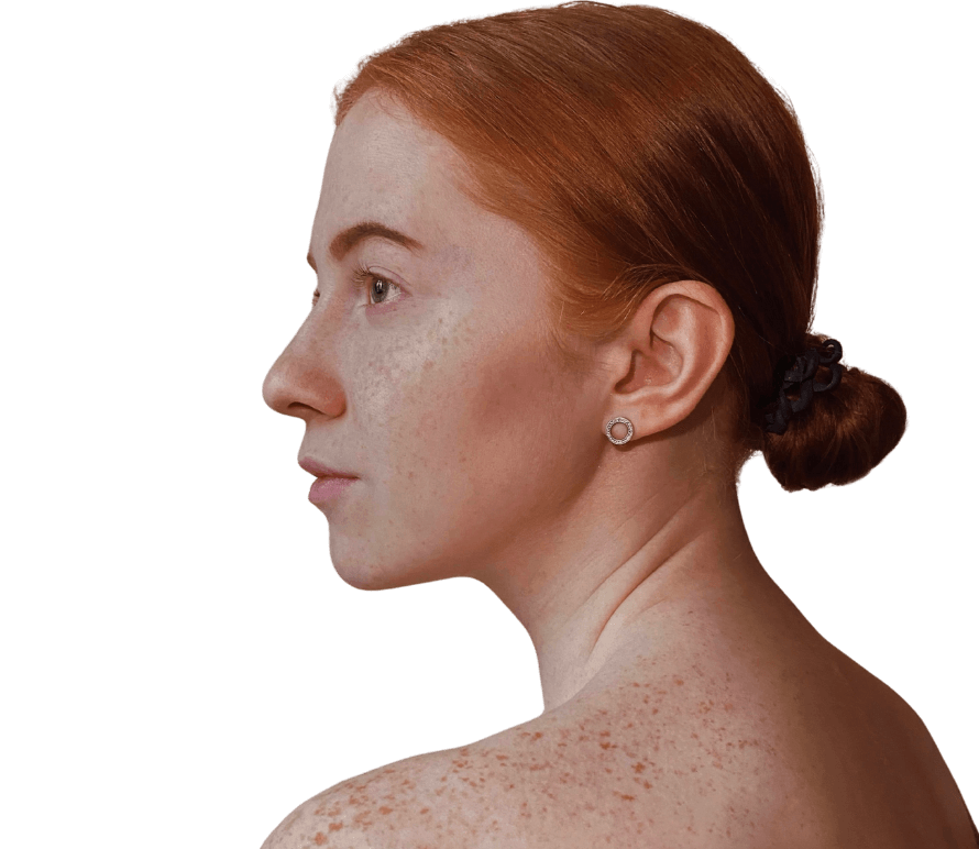 Skin Cancer Treatment