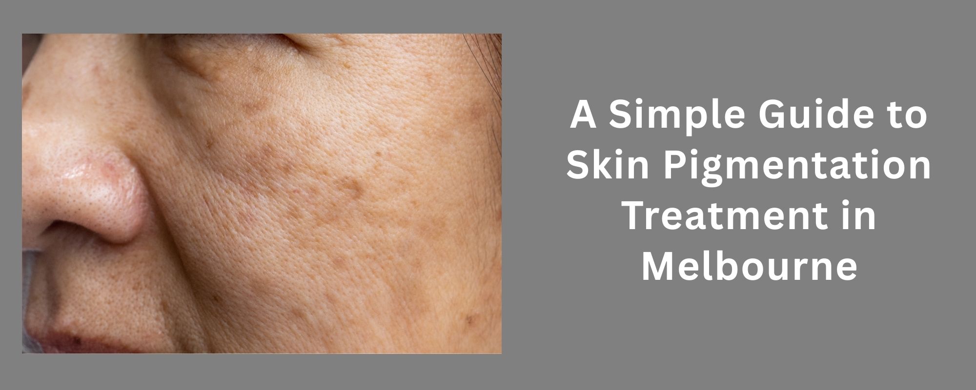 What Is Jawline Dermal Treatment