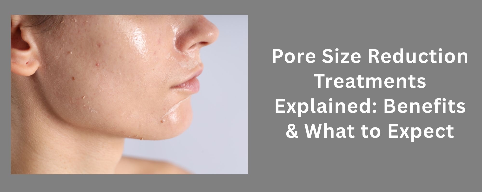 Pore Size Reduction Treatments