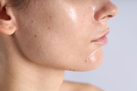 Pore Size Reduction Treatments