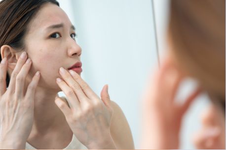 Pore Size Reduction