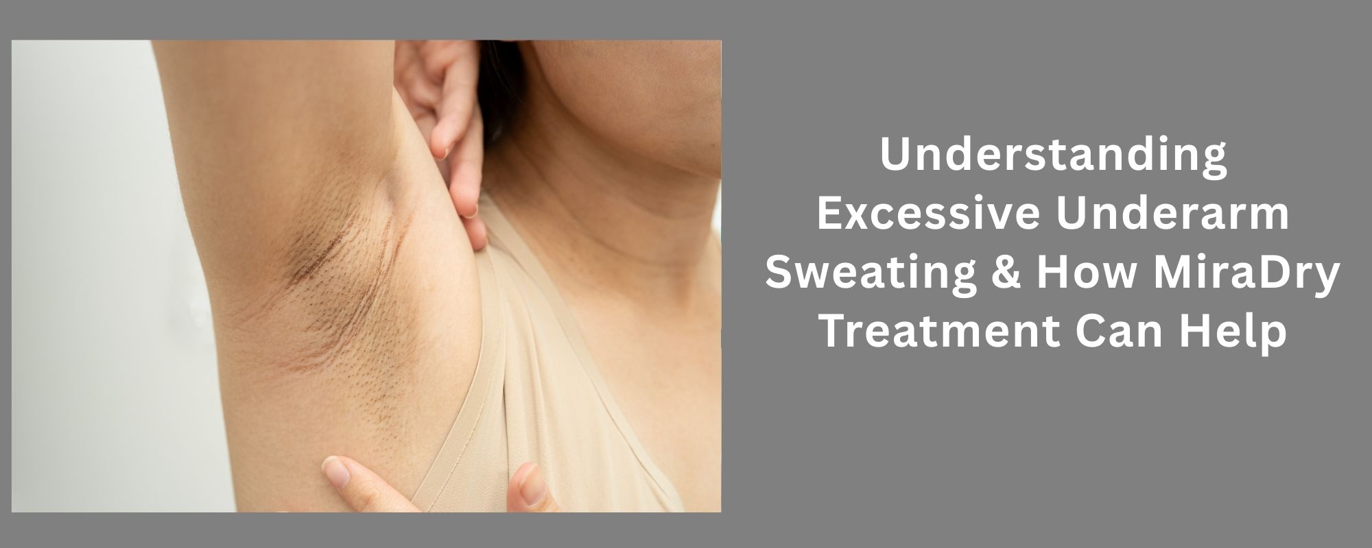 Understanding Excessive Underarm Sweating & How MiraDry Treatment Can Help 1 Excessive Underarm Sweating