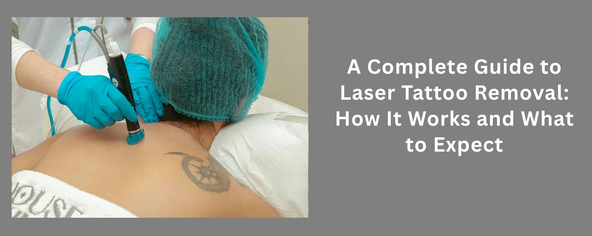 Laser Tattoo Removal