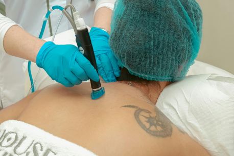 A Complete Guide to Laser Tattoo Removal: How It Works and What to Expect - 2