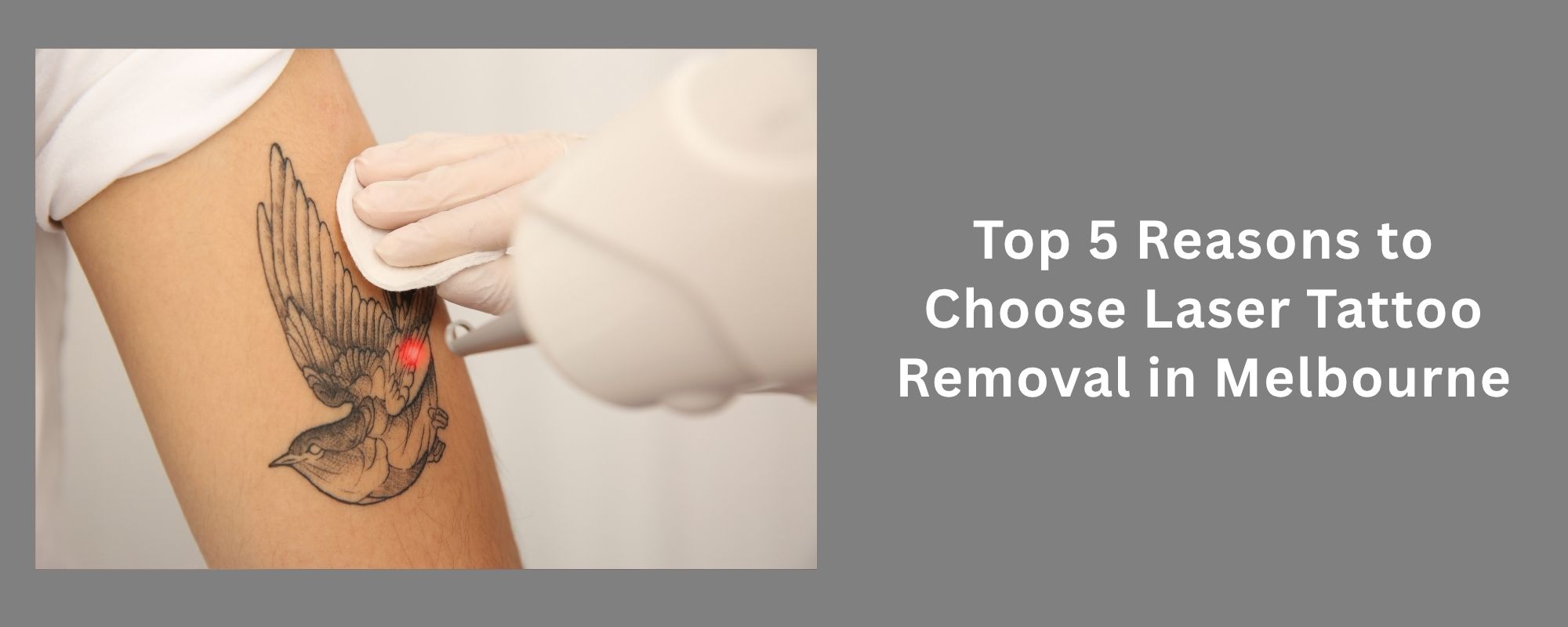 Laser Tattoo Removal