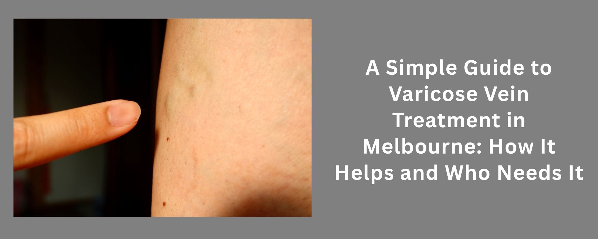 Excessive Underarm Sweating