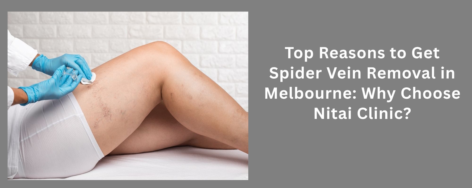 Top Reasons to Get Spider Vein Removal in Melbourne: Why Choose Nitai Clinic? 1 Excessive Underarm Sweating