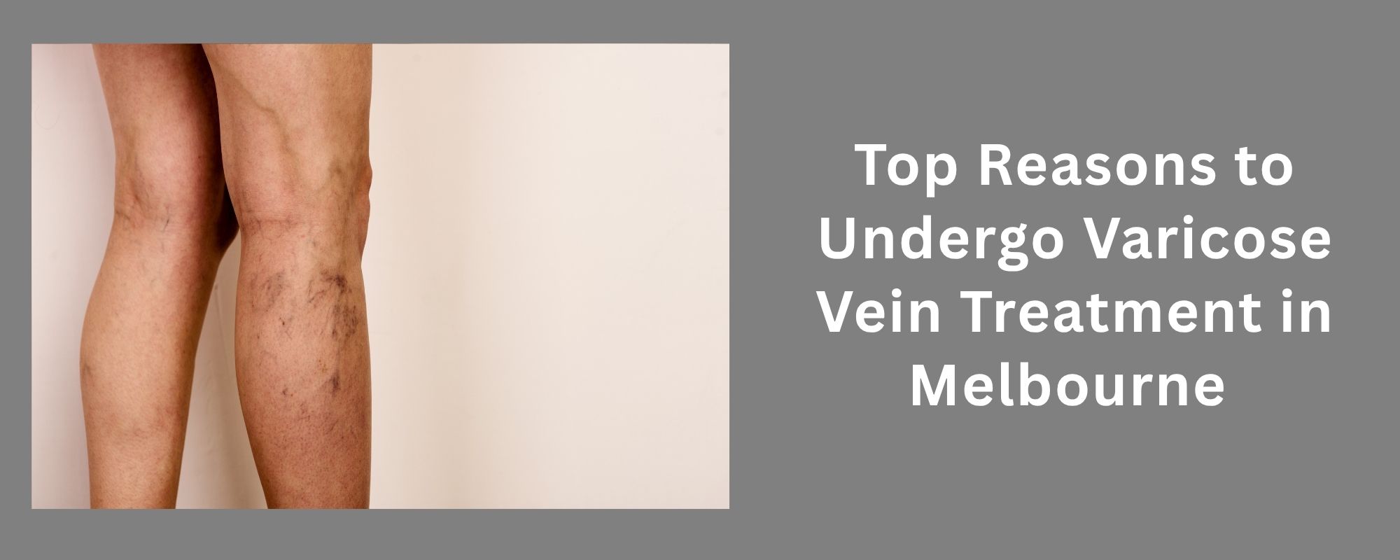 Excessive Underarm Sweating