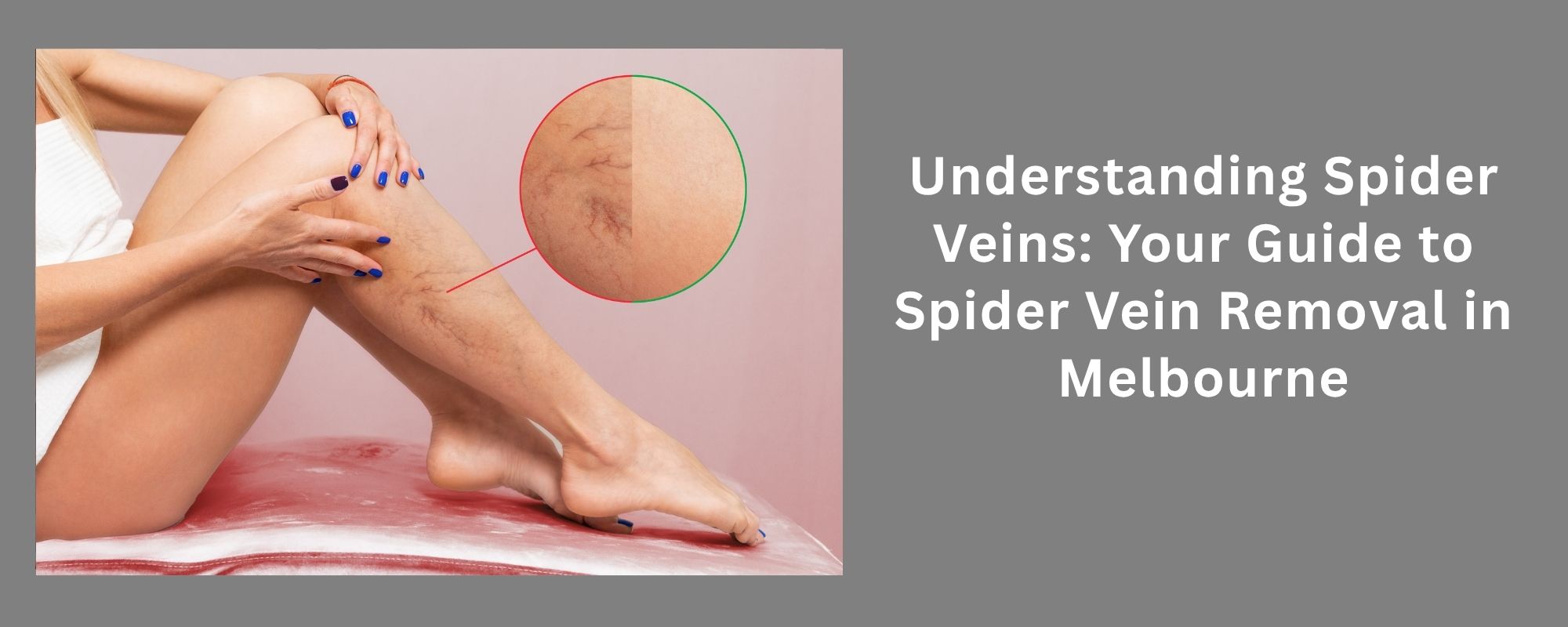 Excessive Underarm Sweating