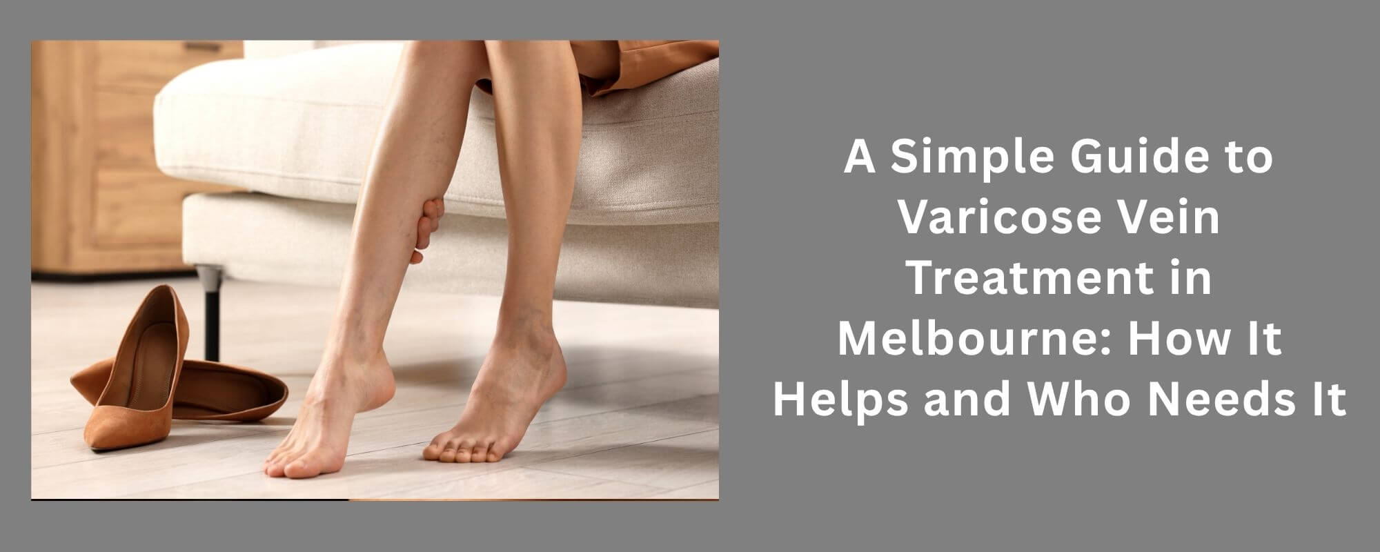 Varicose Vein Treatment