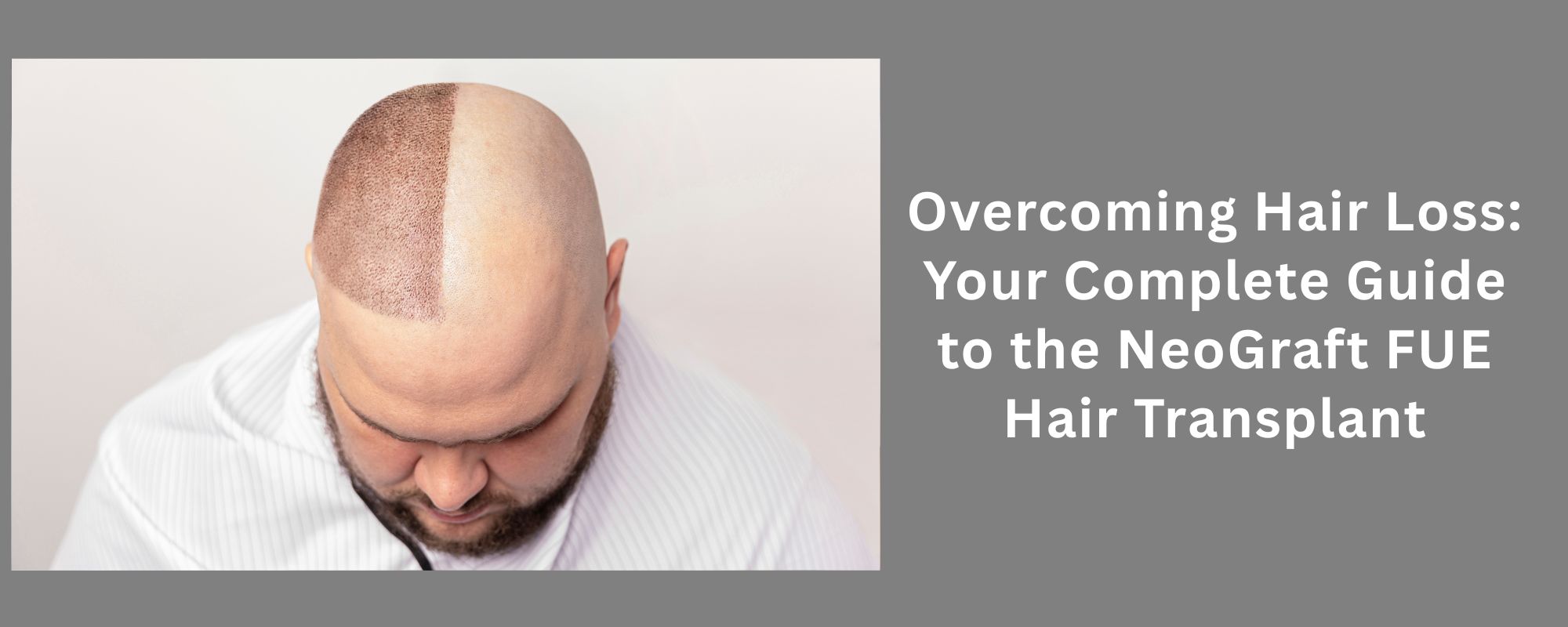 NeoGraft FUE Hair Transplant